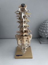 Vintage vioxx spinal for sale  FALMOUTH