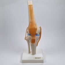 Human knee joint for sale  Shipping to Ireland