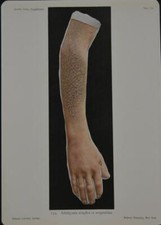 Antique anatomy art for sale  Mishawaka