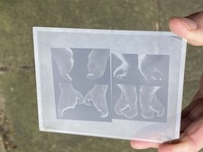 Medical ray photographs for sale  LONDON