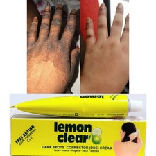 Crème éclaircissante lemon d'occasion  Ronchin