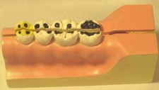 Human tooth teeth for sale  Fremont