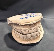 Dental casting human for sale  Asheville