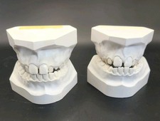 Dental casting human for sale  Monroeville