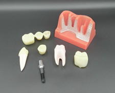 Dental implant times for sale  Dallas