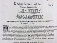 Stomatology 1614 Dentist Artificial Ear Engraving Ambroise Paré Medicine comprar usado  Enviando para Brazil