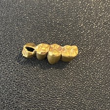Usado, IMPLANTE DE PONTE DENTÁRIA ANTIGO DOURADO ~ 4 TAMPAS DE DENTES ~ FRETE GRÁTIS comprar usado  Enviando para Brazil