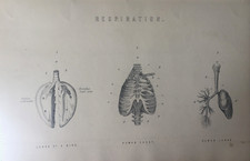 Antique medical print for sale  TORRINGTON