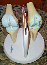 Anatstat artificial knee for sale  Portage