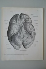 Planche anatomie humaine d'occasion  Marseille IV