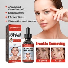 Tender skin care usato  Spedire a Italy