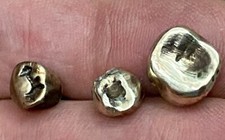 dental crown for sale dental crown for sale Yorktown