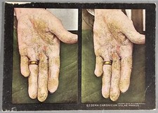 1910 medical skin for sale  Hendersonville