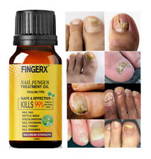 Best fungal nail for sale  LONDON