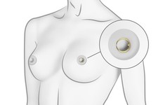 Piercingline brustwarzenpierci gebraucht kaufen  Deutschland