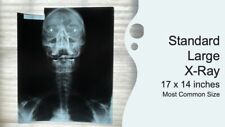 x ray film for sale x ray film for sale Rush City