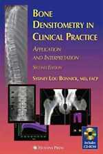 Bone Densitometry in Clinical - Hardcover, by Sydney Lou Bonnick - Acceptable comprar usado  Enviando para Brazil