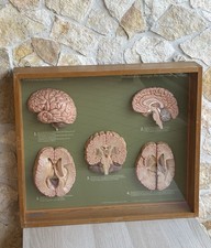 Somso modello anatomico usato  Calvizzano