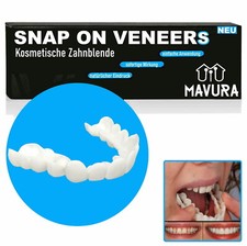 Snap veneers kosmetische gebraucht kaufen  Blomberg