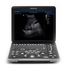 Mindray z60 ultrasound for sale  Atlanta