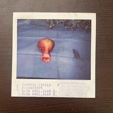 Estranha Polaroid do útero cirurgicamente fora do corpo. Bruto. Estranho. Médico., usado comprar usado  Enviando para Brazil