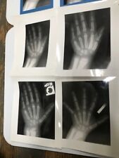 Set mounted medical for sale  Derby