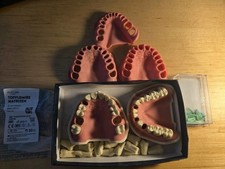 Frasaco modell zähne gebraucht kaufen  Gießen