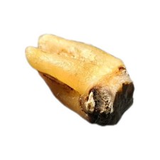 Human molars teeth for sale  Fresno