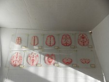 Brain specimen coasters for sale  Friendswood