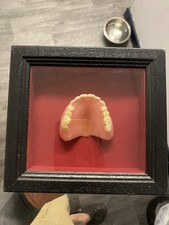 Framed false teeth for sale  CHESTER
