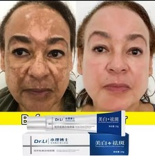Dark spot melasma for sale  LONDON