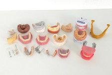 Dental schaumodelle zahnarzt gebraucht kaufen  Paderborn