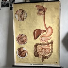 Antique medical poster for sale  LEEK