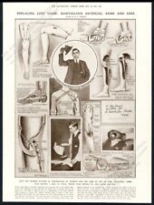 1915 prosthetic artificial for sale  Denver