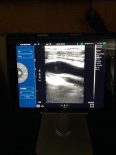 Viatom pro msk for sale  EDINBURGH