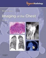 Imaging of the Chest, 2-Volume Set: Expert Radiology Series by comprar usado  Enviando para Brazil