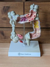 Colon diseased anatomical for sale  NEW MILTON