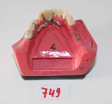 Dent schaumodell abgebildet gebraucht kaufen  Selters
