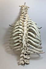 Vintage anatomical part for sale  BROMLEY