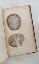 ANATOMY OF THE BRAIN by G. Spurzheim, 1st Edition 1826, Illustrated, Complete. comprar usado  Enviando para Brazil