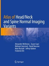 Atlas head neck gebraucht kaufen  Bayreuth
