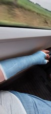 Gipsarm sats links gebraucht kaufen  Düsseldorf
