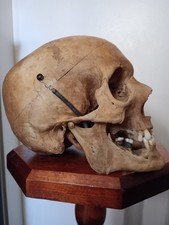 Anatomisches altes schädel gebraucht kaufen  Magdeburg
