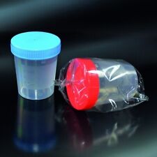 Contenitore per urine usato  Villaricca