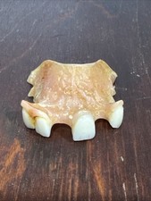 Denture false teeth for sale  Chesterfield