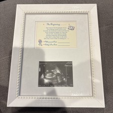 New beginning sonogram for sale  Windermere
