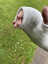 Gipsarm safs weissgips gebraucht kaufen  Bochum