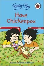 Topsy tim chickenpox for sale  UK