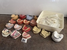 Zahnmodelle modellguss schaumo gebraucht kaufen  Selters