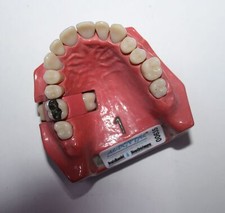 Dent schaumodell 1 gebraucht kaufen  Ransbach-Baumbach